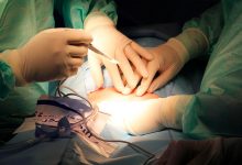 Фото - В Подмосковье хирурги удалили пациентке десятикилограммовую опухоль матки
